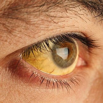 liver-disease-CBD-oil