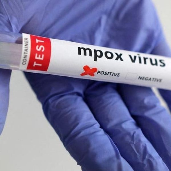 mpox-virus1724197745-4